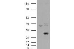 Western blot analysis of LIPG in cell lysates that were transfected with the pCMV6-ENTRY control or pCMV6-ENTRY LIPG cDNA using LIPG polyclonal antibody . (LIPG 抗体  (C-Term))