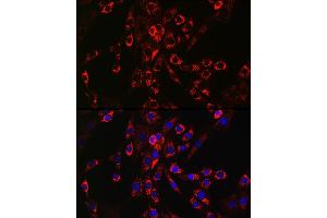 Immunofluorescence analysis of NIH/3T3 cells using HB-EGF Rabbit pAb (ABIN6130449, ABIN6141644, ABIN6141645 and ABIN6218793) at dilution of 1:150 (40x lens). (HBEGF 抗体  (AA 20-160))