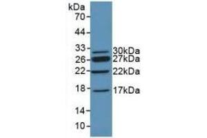 Detection of Recombinant CHD3, Mouse using Polyclonal Antibody to Chromodomain Helicase DNA Binding Protein 3 (CHD3) (CHD3 抗体  (AA 1613-1820))