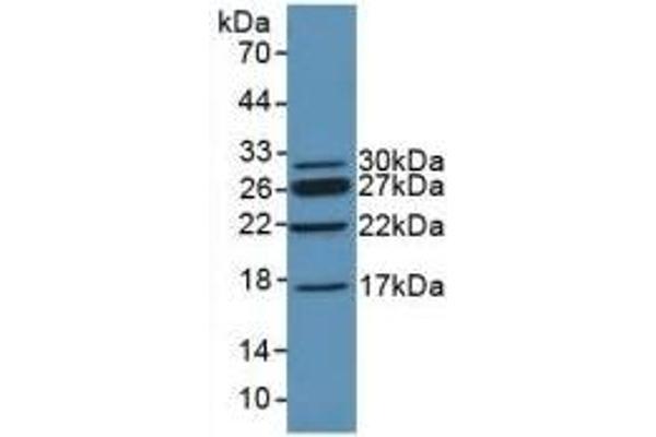 CHD3 anticorps  (AA 1613-1820)