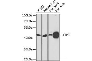 Western blot analysis of extracts of various cell lines using GIPR Polyclonal Antibody at dilution of 1:1000. (GIPR 抗体)