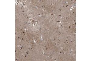 Immunohistochemical staining of human lateral ventricle with SFMBT2 polyclonal antibody  shows strong cytoplasmic positivity in neuronal cells at 1:200-1:500 dilution. (SFMBT2 抗体)