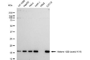 Western blotting analysis using Histone H2B (acetyl K16) antibody (ABIN7798943).