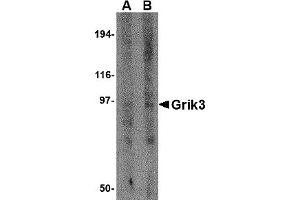 Western Blotting (WB) image for anti-Glutamate Receptor, Ionotropic, Kainate 3 (GRIK3) (N-Term) antibody (ABIN1031396) (GRIK3 抗体  (N-Term))