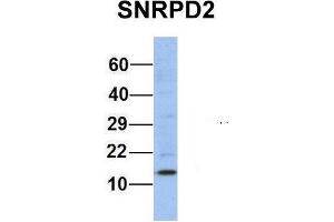 Western Blotting (WB) image for anti-Small Nuclear Ribonucleoprotein D2 Polypeptide 16.5kDa (SNRPD2) (Middle Region) antibody (ABIN2778903)