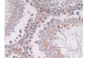 DAB staining on IHC-P; Samples: Rat Intestine Tissue (IL-4 抗体  (AA 61-111))