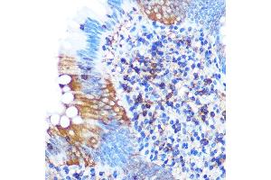 Immunohistochemistry of paraffin-embedded human appendix using PG Rabbit mAb (ABIN1679556, ABIN3018645, ABIN3018646 and ABIN7101637) at dilution of 1:100 (40x lens). (PGAM1 抗体)