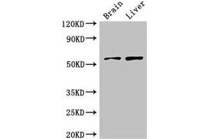 Western Blot Positive WB detected in: Mouse brain tissue, Rat liver tissue All lanes: KCNA1 antibody at 3 μg/mL Secondary Goat polyclonal to rabbit IgG at 1/50000 dilution Predicted band size: 57 kDa Observed band size: 57 kDa (KCNA1 抗体  (AA 7-150))