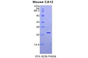 SDS-PAGE (SDS) image for Carbonic Anhydrase 12 (CA12) (AA 161-318) protein (His tag) (ABIN1877243) (CA12 Protein (AA 161-318) (His tag))