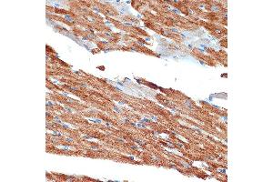 Immunohistochemistry of paraffin-embedded rat heart using NDUFB8 Rabbit mAb (ABIN7268813) at dilution of 1:100 (40x lens).