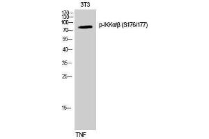 Western Blotting (WB) image for anti-IKK-alpha /IKK-beta (pSer176), (pSer177) antibody (ABIN3182040) (IKK-alpha /IKK-beta 抗体  (pSer176, pSer177))