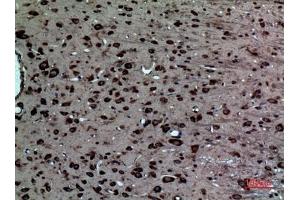 Immunohistochemical analysis of paraffin-embedded rat-brain, antibody was diluted at 1:100.