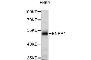 Western blot analysis of extracts of H460 cells, using ENPP4 antibody (ABIN5972569) at 1:3000 dilution. (ENPP4 抗体)