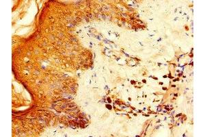 Immunohistochemistry of paraffin-embedded human skin tissue using ABIN7142567 at dilution of 1:100 (RPS6 抗体  (AA 35-229))