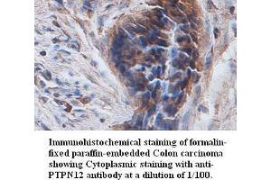 Image no. 1 for anti-Protein Tyrosine Phosphatase G1 (PTPN12) antibody (ABIN791170) (PTPN12 抗体)