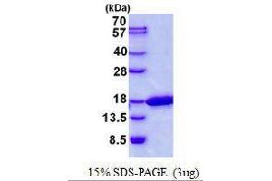 Figure annotation denotes ug of protein loaded and % gel used. (CDK2AP2 蛋白)