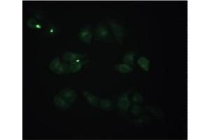 Staining of methanol-fixed Hela cells by Immunocytochemistry using Mouse anti-Human beta 2 Microglobulin monoclonal antibody (D2E9) at 1/50 (20 µg/ml). (beta-2 Microglobulin 抗体)