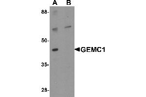 Western blot analysis of GEMC1 in mouse heart tissue lysate with GEMC1 antibody at 1 µg/mL in (A) the absence and (B) the presence of blocking peptide
