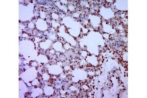 Paraformaldehyde-fixed, paraffin embedded rat lung; Antigen retrieval by boiling in sodium citrate buffer (pH6. (GATA5 抗体  (AA 161-260))