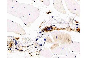 Immunohistochemistry analysis of paraffin-embedded mouse skeletal muscle using DLL4 Polyclonal Antibody at dilution of 1:200. (DLL4 抗体)
