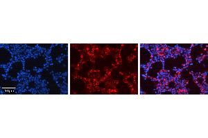 Rabbit Anti-ATF4 Antibody   Formalin Fixed Paraffin Embedded Tissue: Human Bone Marrow Tissue Observed Staining: Cytoplasm, Nucleus Primary Antibody Concentration: 1:600 Other Working Concentrations: N/A Secondary Antibody: Donkey anti-Rabbit-Cy3 Secondary Antibody Concentration: 1:200 Magnification: 20X Exposure Time: 0. (ATF4 抗体  (N-Term))