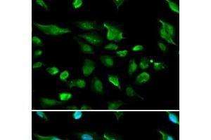 Immunofluorescence analysis of A549 cells using AIRE Polyclonal Antibody (AIRE 抗体)