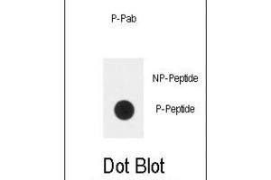 Dot Blot (DB) image for anti-Plexin D1 (PLXND1) (pTyr1642) antibody (ABIN3001877) (PLXND1 抗体  (pTyr1642))