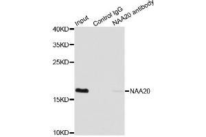 Immunoprecipitation analysis of 200 μg extracts of MCF7 cells using 1 μg NAA20 antibody (ABIN5974272). (NAT5 抗体)