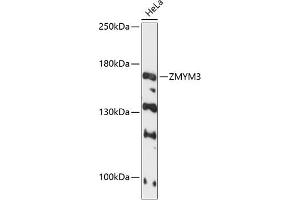 Western blot analysis of extracts of HeLa cells, using ZMYM3 antibody (ABIN6128940, ABIN6150453, ABIN6150454 and ABIN6216809) at 1:3000 dilution.