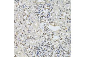 Immunohistochemistry of paraffin-embedded rat kidney using DR1 Antibody (ABIN2562286) at dilution of 1:100 (40x lens). (DR1 抗体)