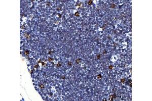 IHC analysis of Il2ra using anti-Il2ra antibody (ABIN7600684).