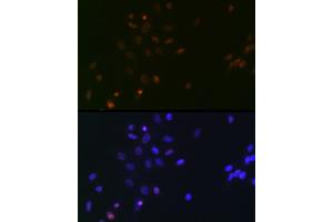 Immunofluorescence analysis of NIH/3T3 cells using SUPT5H/SPT5 Rabbit mAb (ABIN7270878) at dilution of 1:100 (40x lens). (SUPT5H 抗体)