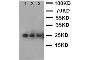 Anti-VEGF antibody, Western blotting Lane 1: Recombinant Human VEGF Protein 10ng Lane 2: Recombinant Human VEGF Protein 5ng Lane 3: Recombinant Human VEGF Protein 2.