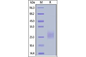 SDS-PAGE (SDS) image for Killer Cell Lectin-Like Receptor Subfamily D, Member 1 (KLRD1) (AA 32-179) protein (His tag) (ABIN6938877)