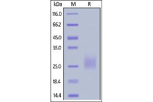 Human CD94, His Tag on  under reducing (R) condition. (CD94 Protein (AA 32-179) (His tag))