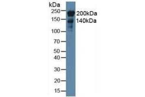 Detection of NES in Rat Heart Tissue using Monoclonal Antibody to Nestin (NES) (Nestin 抗体  (AA 178-399))