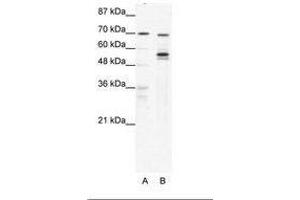 Image no. 1 for anti-DEAD (Asp-Glu-Ala-Asp) Box Polypeptide 55 (DDX55) (AA 92-141) antibody (ABIN6736047) (DDX55 抗体  (AA 92-141))