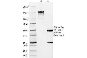 SDS-PAGE (SDS) image for anti-Vimentin (VIM) antibody (ABIN6940879)
