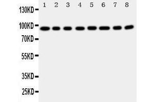 Western Blotting (WB) image for anti-Coagulation Factor VIII (F8) (AA 1264-1278), (Middle Region) antibody (ABIN3042924)