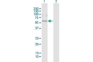 Western Blot analysis of CRISPLD1 expression in transfected 293T cell line by CRISPLD1 MaxPab polyclonal antibody. (CRISPLD1 抗体  (AA 1-500))