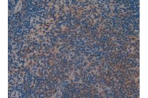 Detection of MAP2K2 in Mouse Spleen Tissue using Polyclonal Antibody to Mitogen Activated Protein Kinase Kinase 2 (MAP2K2) (MEK2 抗体  (AA 44-313))