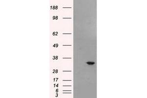 HEK293T cells were transfected with the pCMV6-ENTRY control (Left lane) or pCMV6-ENTRY BIRC7 (Right lane) cDNA for 48 hrs and lysed. (BIRC7 抗体)