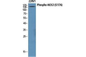 Western Blot (WB) analysis of specific cells using Phospho-NOS3 (S1177) Polyclonal Antibody. (ENOS 抗体  (pSer1177))