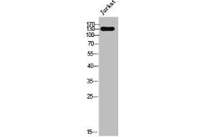 Western Blot analysis of Jurkat cells using Nesprin-3 Polyclonal Antibody (Nesprin3 抗体  (Internal Region))