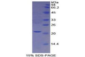 SDS-PAGE analysis of Human Protein S Protein. (PROS1 蛋白)