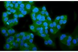 IF analysis of WFS1 using anti-WFS1 antibody (ABIN7602165).