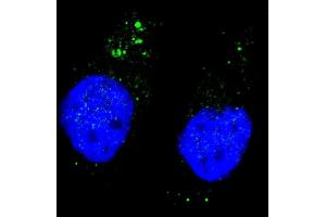 Fluorescent image of  cells stained with ULK1 (phospho ) antibody. (ULK1 抗体  (pSer556))