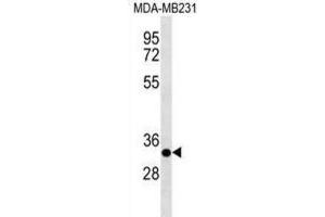 Western Blotting (WB) image for anti-Calpain, Small Subunit 2 (CAPNS2) antibody (ABIN3000891) (CAPNS2 抗体)