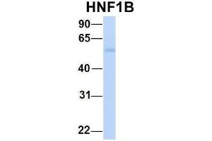 Western Blotting (WB) image for anti-HNF1 Homeobox B (HNF1B) (N-Term) antibody (ABIN2777700)