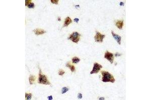 Immunohistochemical analysis of HuC staining in rat brain formalin fixed paraffin embedded tissue section. (HuC/ELAVL3 抗体)